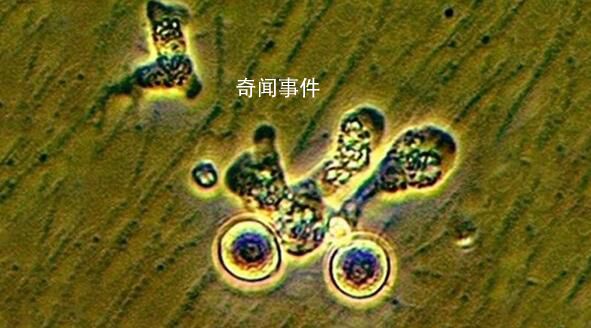 韓國(guó)報(bào)告首例“食腦蟲”病例 從泰國(guó)回國(guó)后死亡