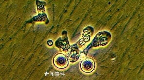 新冠肺炎更名為新冠感染 下月8日起實施乙類乙管
