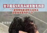 專家:陽康后超30%的人面臨脫發風險