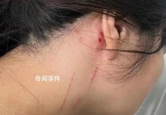 回家過年拒絕相親 河南母女被打入院