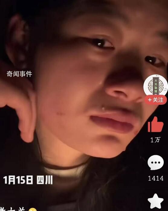 女孩稱因戴了弟弟帽子被母親打 臉上下巴出現很多指甲印和血漬