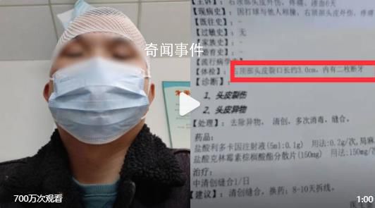 男子打球6天后頭皮里發現2顆牙 最后醫生取出牙碎顆粒傷口縫了4針