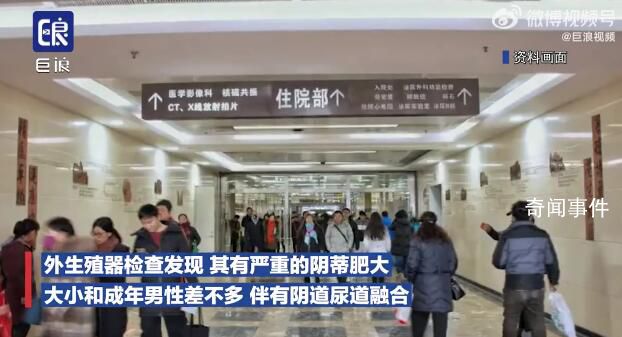 夫妻連生兩胎均患怪病性別難辨 確診先天性腎上腺皮質增生癥