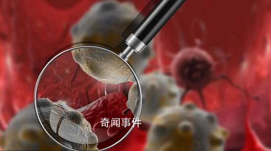 中國癌癥死亡50年:肺癌增長最快