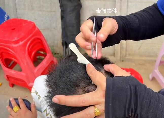 三亞發現拔白發服務 1小時收50元