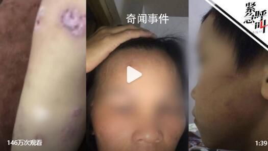 婦聯(lián)回應(yīng)女孩自曝全家被父親家暴 聯(lián)合公安等上門調(diào)查