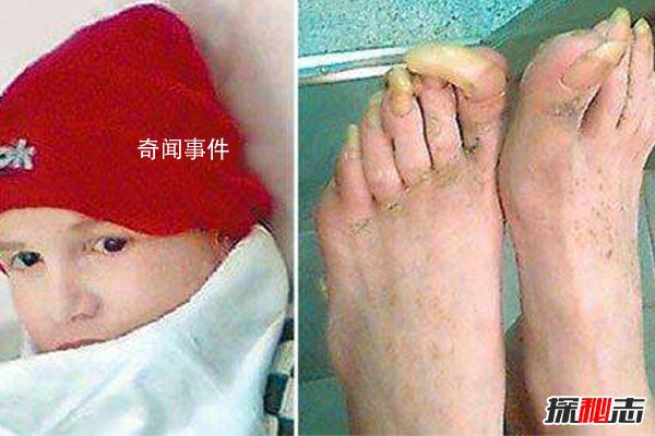 最快適應社會的獸孩：猴孩 猴孩是十大獸孩之一