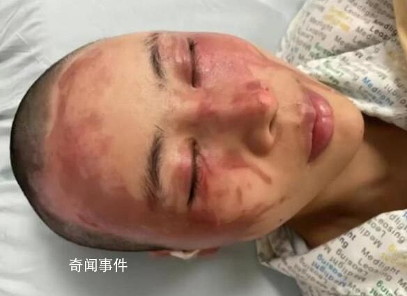 向妻子潑硫酸男子:很后悔 同意離婚