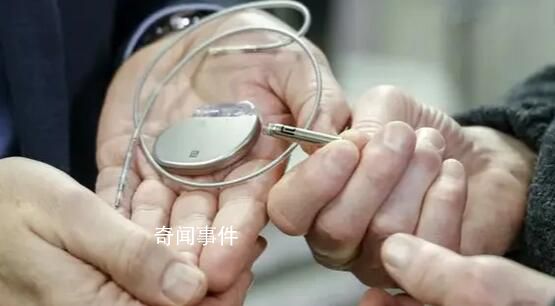 羅馬尼亞5醫生取死者人工心臟再用 被刑事調查