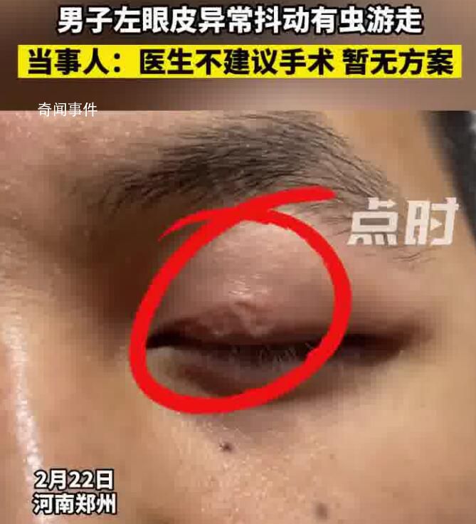 男子左眼皮異常抖動有蟲游走 醫生不建議手術