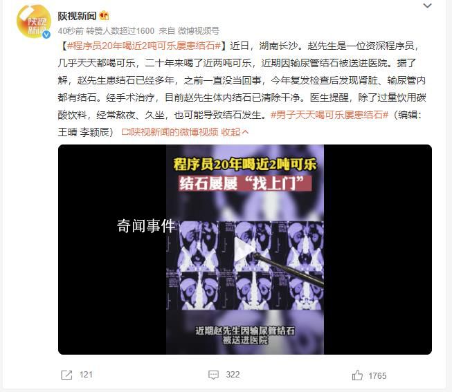 程序員20年喝近2噸可樂屢患結(jié)石 患結(jié)石已經(jīng)多年
