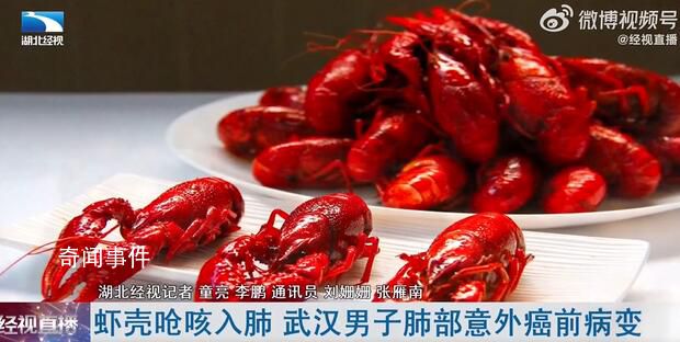 男子咳嗽半年多才知肺中嗆入蝦殼 肺部有大面積感染現象