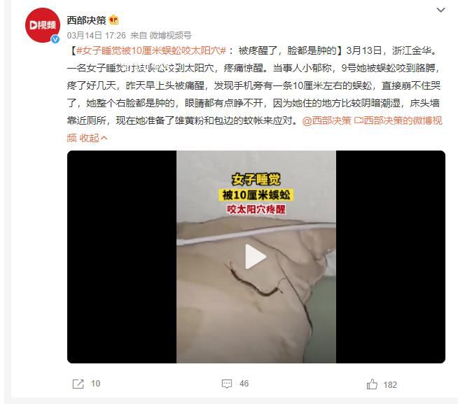 女子睡覺時被10厘米蜈蚣咬太陽穴 被疼醒了臉都是腫的