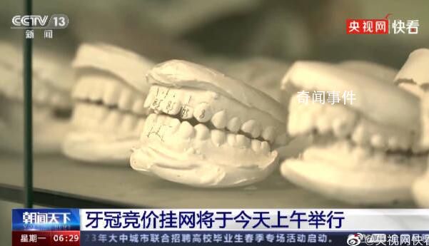種牙費用有望降低50% 價格調控目標為4500元