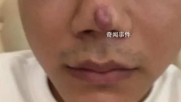 男子整形后稱沒法靠顏值吃飯了 現(xiàn)在沒法繼續(xù)工作了