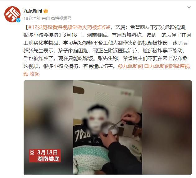 12歲男孩看短視頻學做火藥被炸傷 現在只能吃稀飯