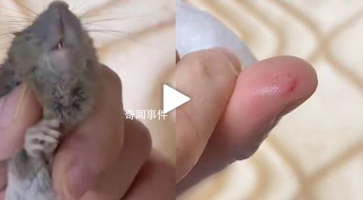女子徒手抓老鼠玩不慎被咬傷 打針花了1000多