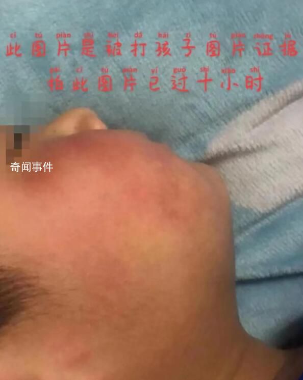 要求小學生互扇耳光上百次教官被拘 后續情況還在處理中