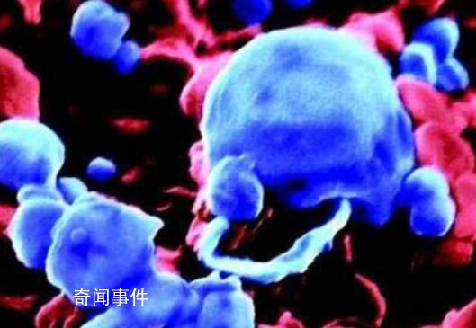 禽流感或成新的大流行毒株來源 人類對這種病毒幾乎沒有免疫力