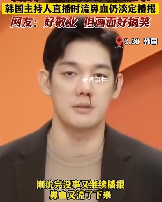 韓國主持人流鼻血仍淡定直播 面不改色坐在原地