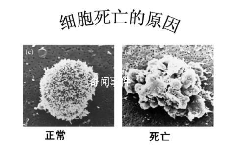 細胞衰老可能與基因表達錯誤有關 無法正常合成蛋白質