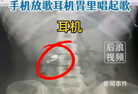 男子誤吞耳機肚子傳出歌聲 稱目前自己是吃瀉藥希望能排出耳機