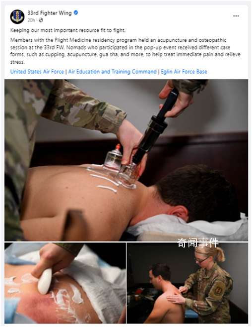 美軍曬士兵拔火罐照片 為保持戰(zhàn)斗力