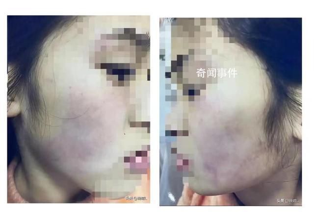 教育局回應學生遭老師挨個抽打 教師已免職