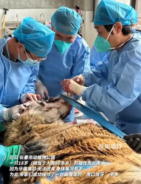 吉林長春現實版虎口拔牙 成功完成了一臺高難度的虎口拔牙手術