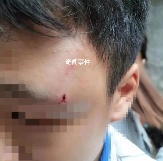 學(xué)生被老師丈夫刺傷?學(xué)校回應(yīng)