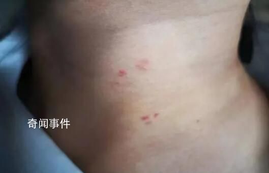 16歲女生拒去酒吧遭室友毆打 警方以尋釁滋事對施暴者立案偵查