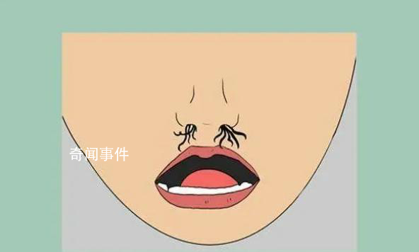 男子剪鼻毛致鼻腔感染 住院12天