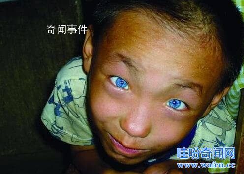 廣西貓眼男孩之謎 廣西貓眼男孩還活著嗎
