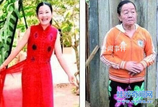 越南23歲少女閃電衰老之謎 瞬間衰老是怎么回事