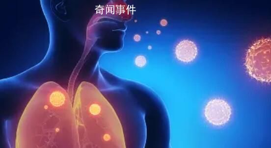 多國出現偏肺病毒感染 尚無治療藥物