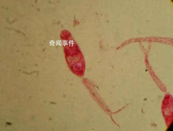 疾控提醒血吸蟲接觸10秒即可感染 警惕江水中的隱形殺手