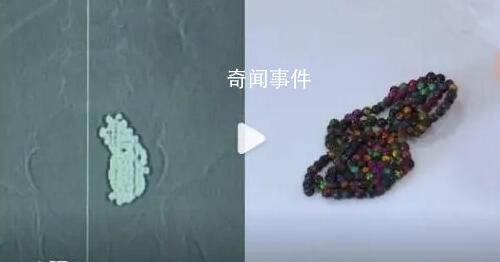 女童吞下上百顆磁力珠腸道如魚籽 家長在看護時需謹慎