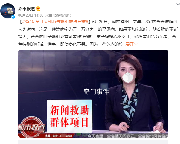 3歲女童患罕見病 肚大如石鼓