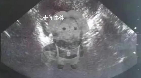 蔡徐坤被曝還有另一位秘密情人 將公布親密照片和視頻 