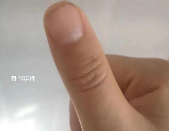 荔枝季致廣東人拇指成黑色 今年荔枝最佳賞味期還有7-10天