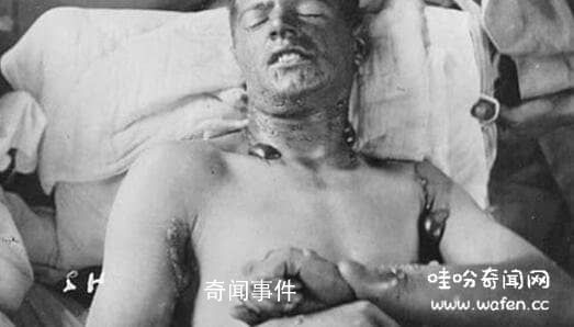 中國所遭受的化學戰爭 十個化學戰的可怕之處 化學戰有多么可怕