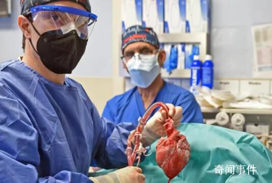 全球首例豬心臟移植人類失敗原因 讓人無比惋惜