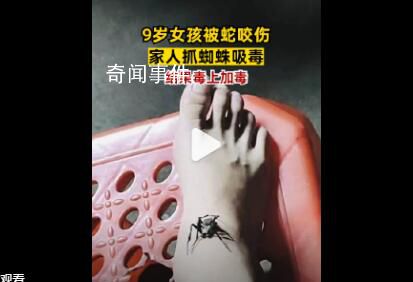 女孩被蛇咬傷奶奶抓蜘蛛吸毒 不僅沒有好轉反而口腔出血嚴重