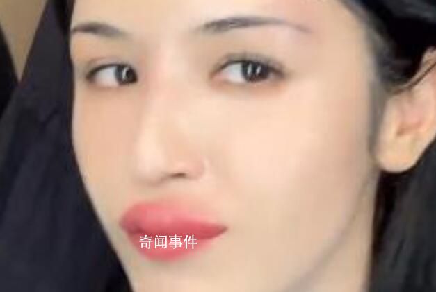 哈妮克孜被蚊子咬成香腸嘴 標(biāo)注：這是一個悲傷的故事請大家嚴(yán)肅觀看
