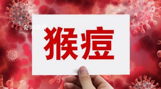 本輪猴痘疫情主要通過男男傳播 新增報告106例猴痘確診病例