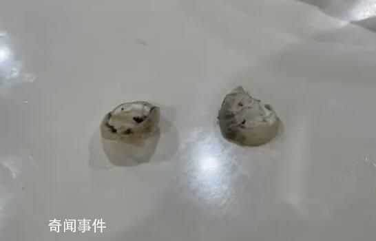 異物是鴨眼鞏膜?記者解剖多個鴨頭