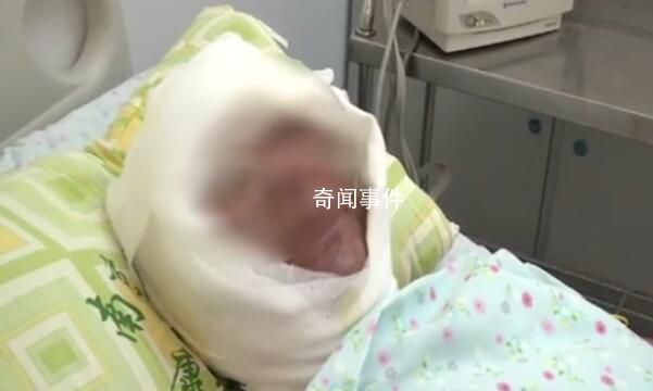 老人進廚房沒多久煤氣發生爆炸 老人已送醫
