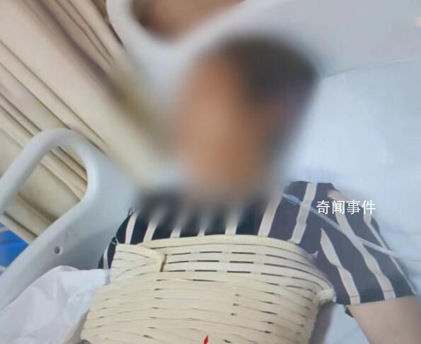 奶奶疑罵孫子被誤會遭圍毆骨折 造成3根肋骨骨折
