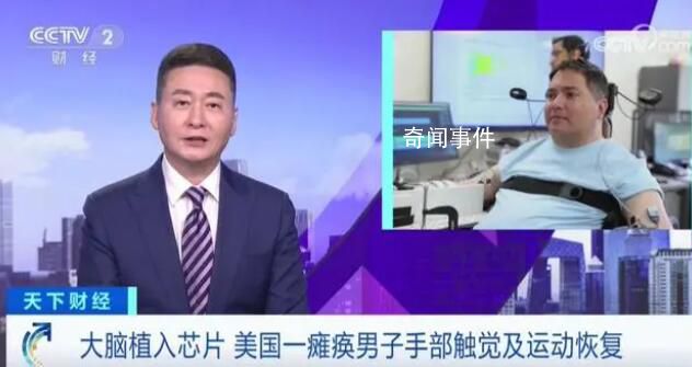 癱瘓男子大腦植入芯片觸覺恢復 實在是太神奇了