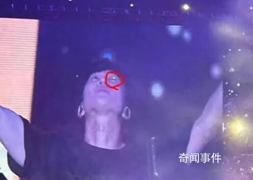 林俊杰被激光筆照眼 為何會(huì)有人做出如此惡劣的行徑